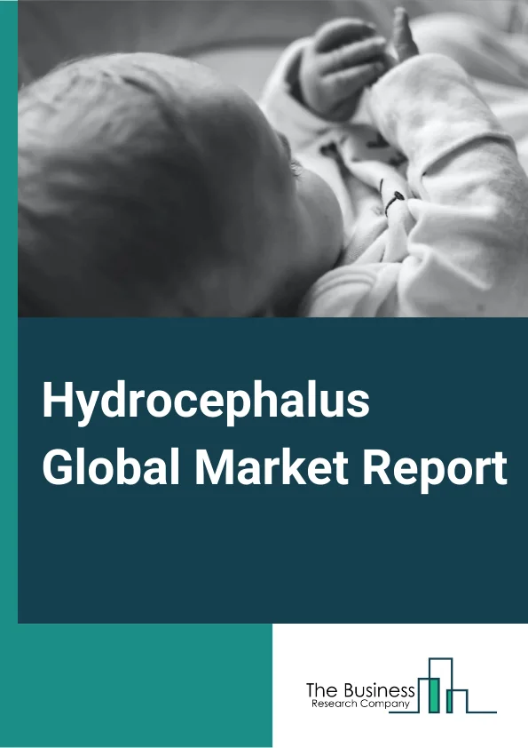 Hydrocephalus Global Market Report 2024 – By Type (Congenital Hydrocephalus, Acquired Hydrocephalus, Normal-Pressure Hydrocephalus, Ex-Vacuo Hydrocephalus), By Age Group (Pediatric, Adult), By Diagnostics (MRI, CT Scan, Head ultrasound, Other Diagnostics), By End User (Hospitals, Diagnostic Centers, Academic Institutions, Research Organizations) – Market Size, Trends, And Global Forecast 2024-2033
