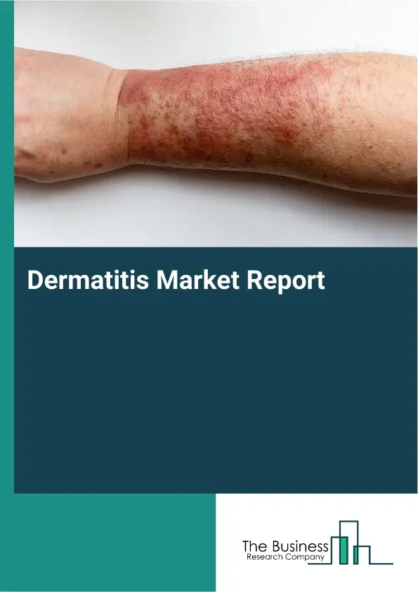 Global Dermatitis Market Report 2026