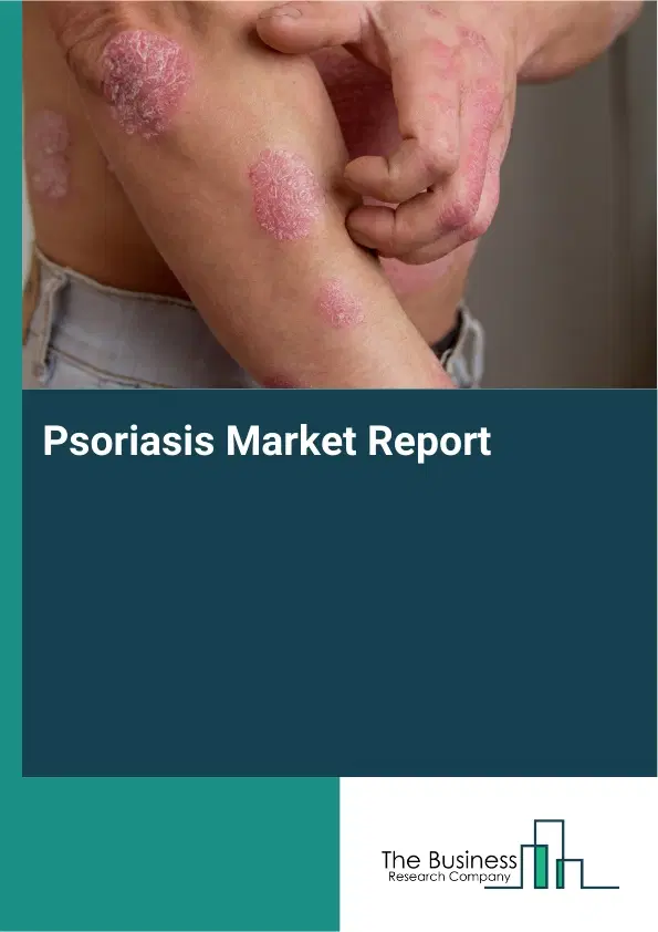 Global Psoriasis Market Report 2026