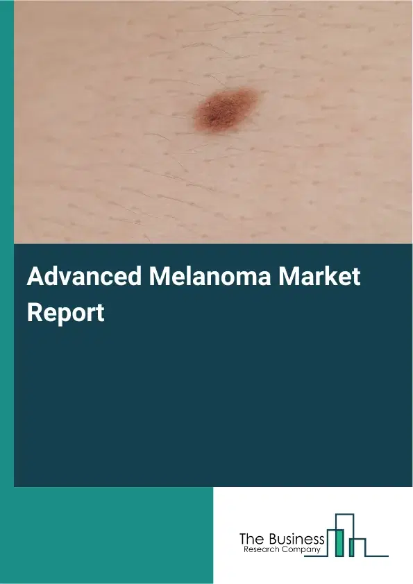 Global Advanced Melanoma Market Report 2026