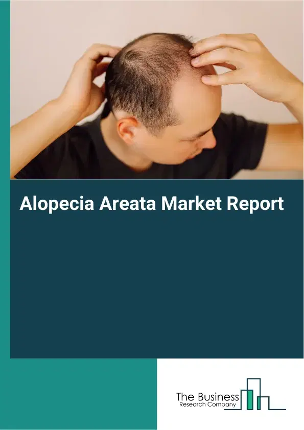 Global Alopecia Areata Market Report 2026