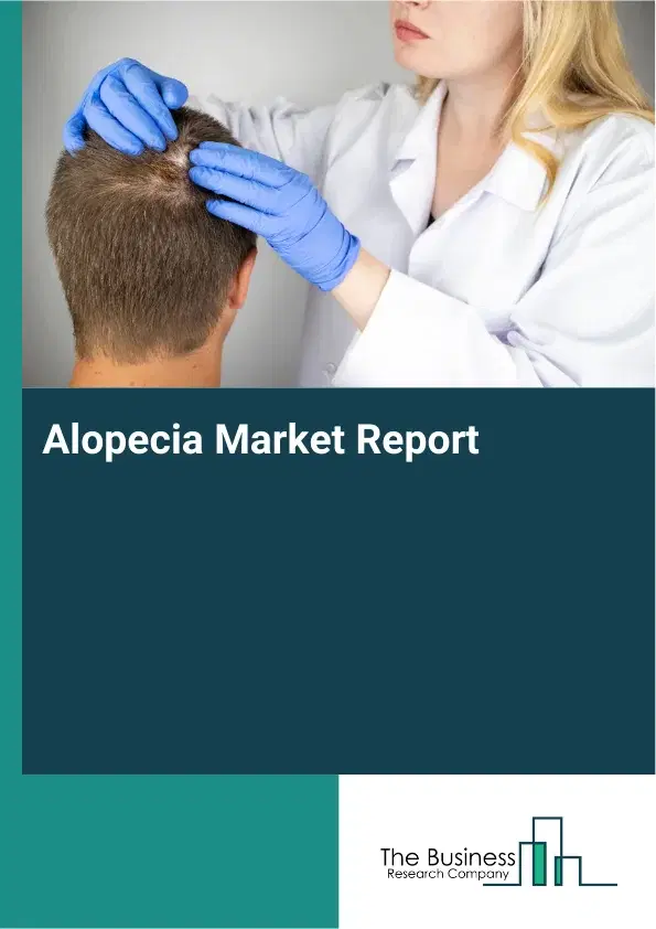 Global Alopecia Market Report 2026
