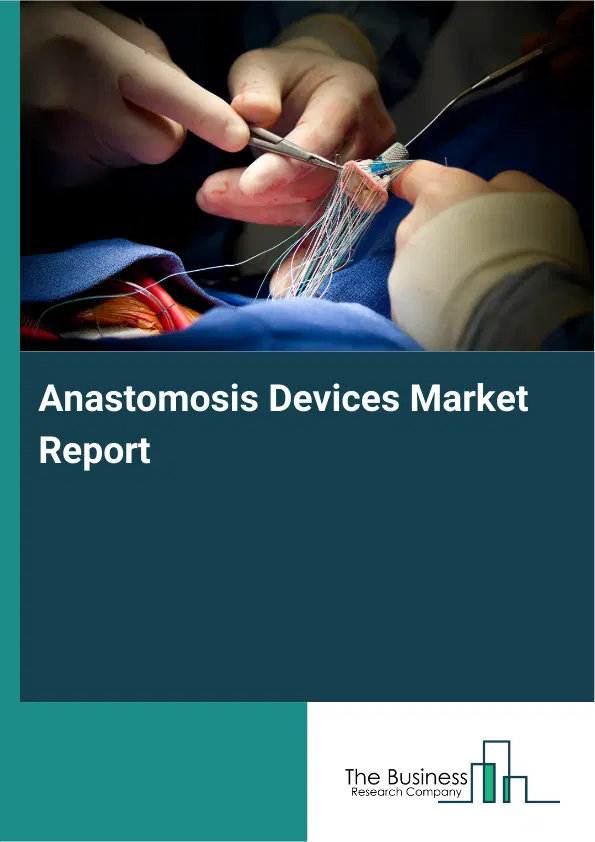 Global Anastomosis Devices Market Report 2026