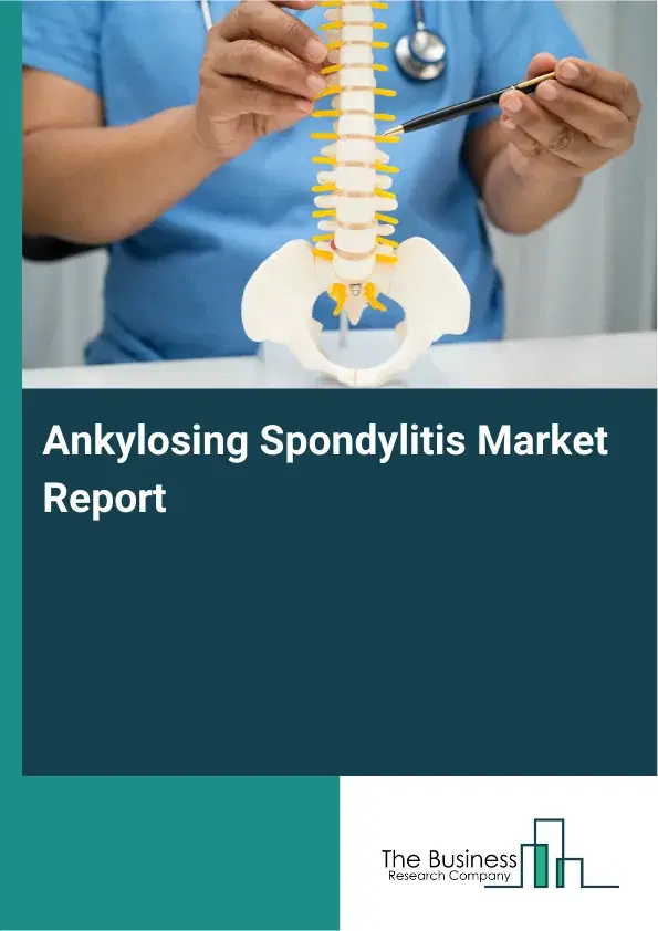 Global Ankylosing Spondylitis Market Report 2026