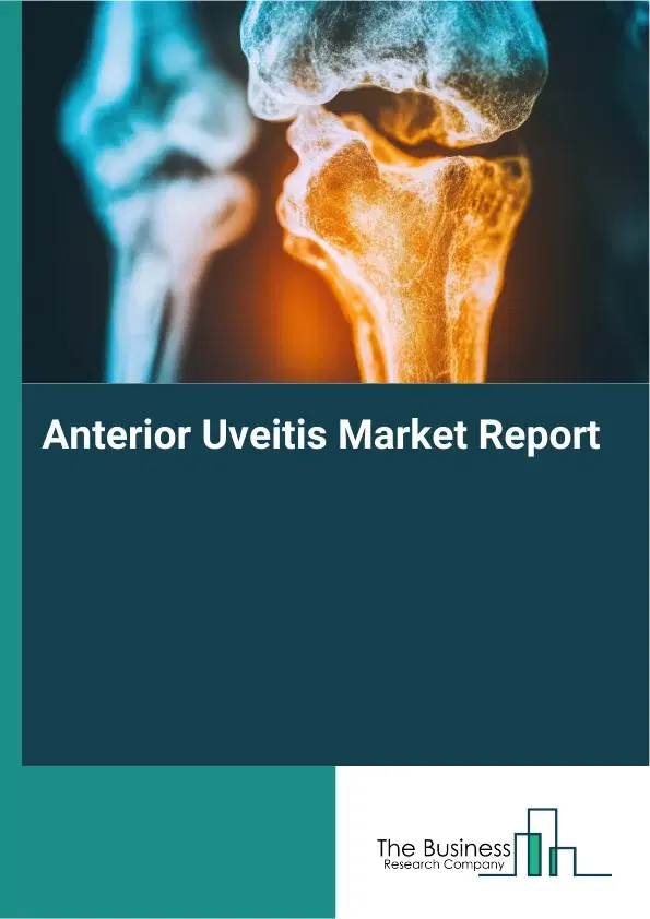 Global Anterior Uveitis Market Report 2026