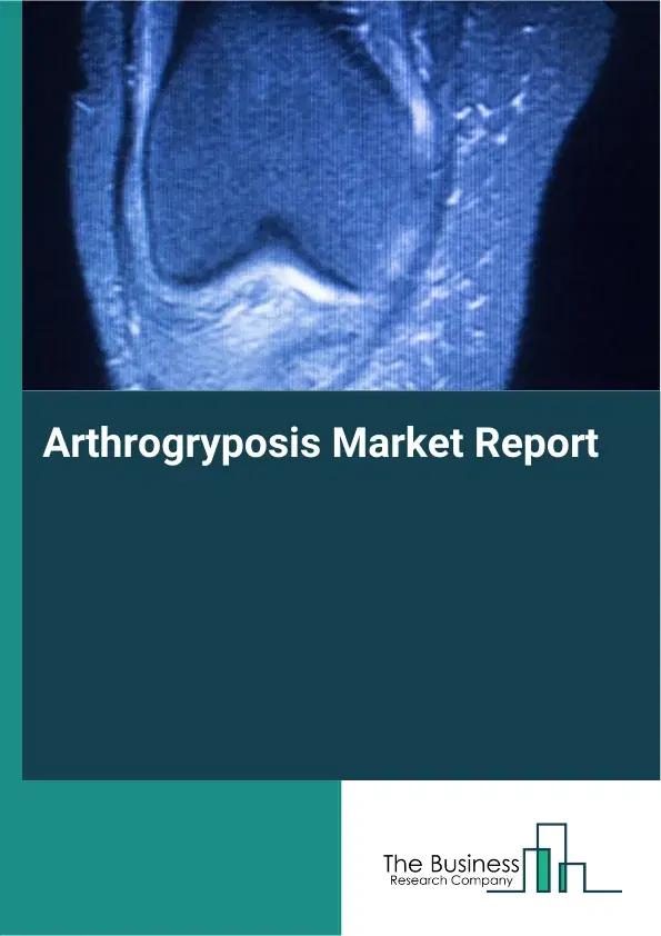 Global Arthrogryposis Market Report 2026