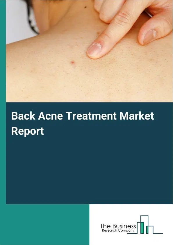Global Back Acne Treatment Market Report 2026