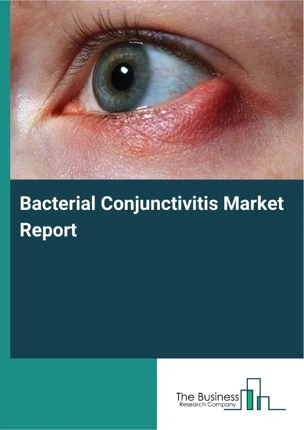 Global Bacterial Conjunctivitis Market Report 2026