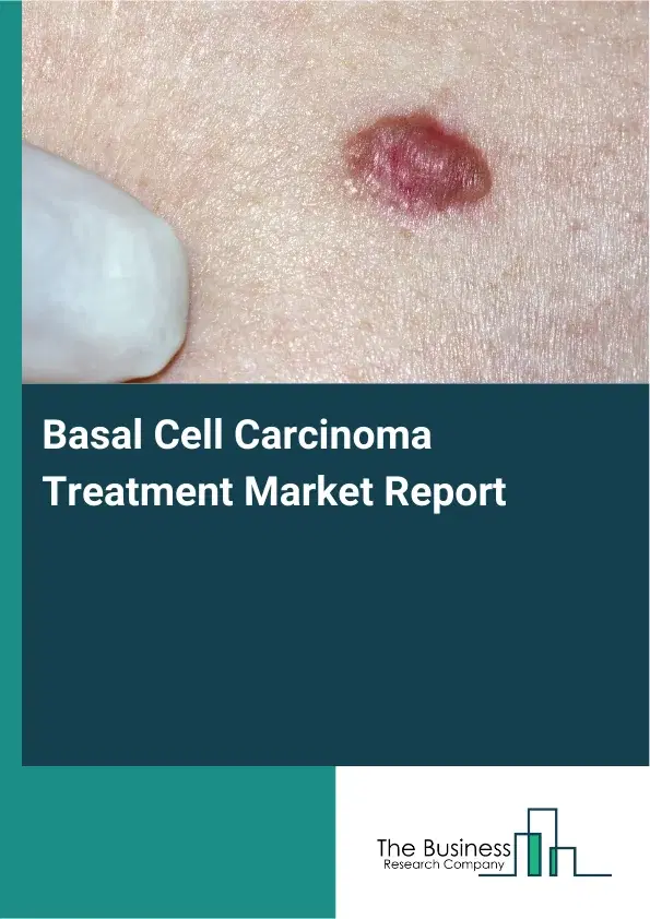 Global Basal Cell Carcinoma Treatment Market Report 2026