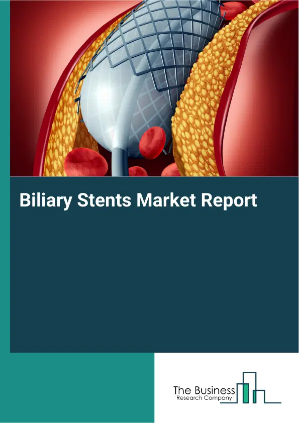Global Biliary Stents Market Report 2026