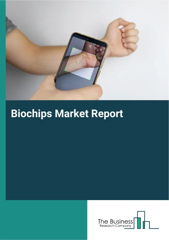 Global Biochips Market Report 2026