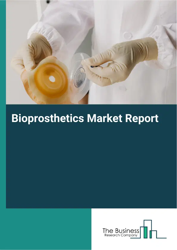 Global Bioprosthetics Market Report 2026