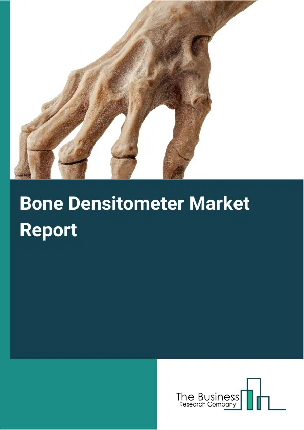 Global Bone Densitometer Market Report 2026