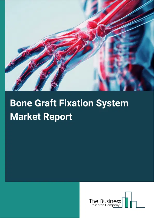 Global Bone Graft Fixation System Market Report 2026