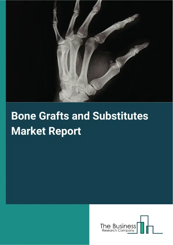 Global Bone Grafts and Substitutes Market Report 2026