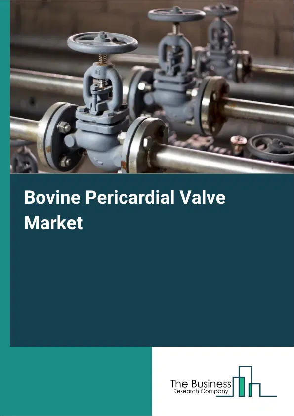 Bovine Pericardial Valve Market Report 2026