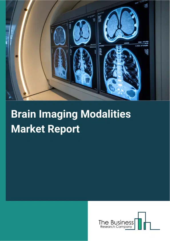 Global Brain Imaging Modalities Market Report 2026