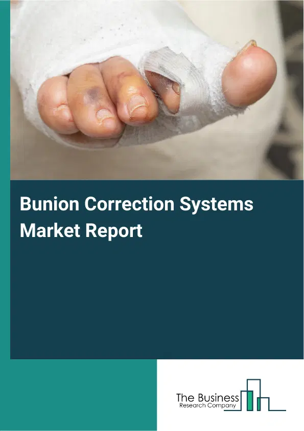 Global Bunion Correction Systems Market Report 2026