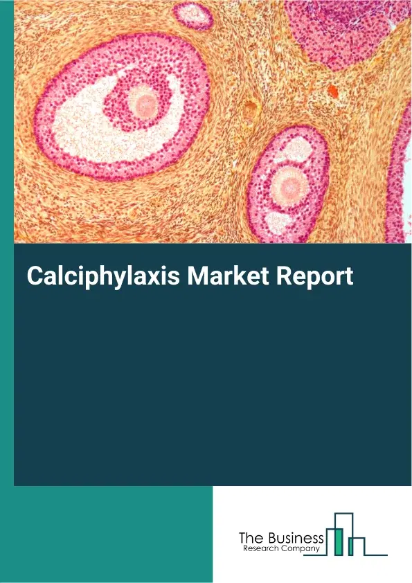 Global Calciphylaxis Market Report 2026