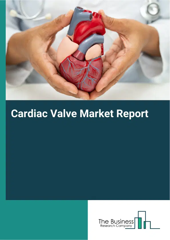 Global Cardiac Valve Market Report 2026