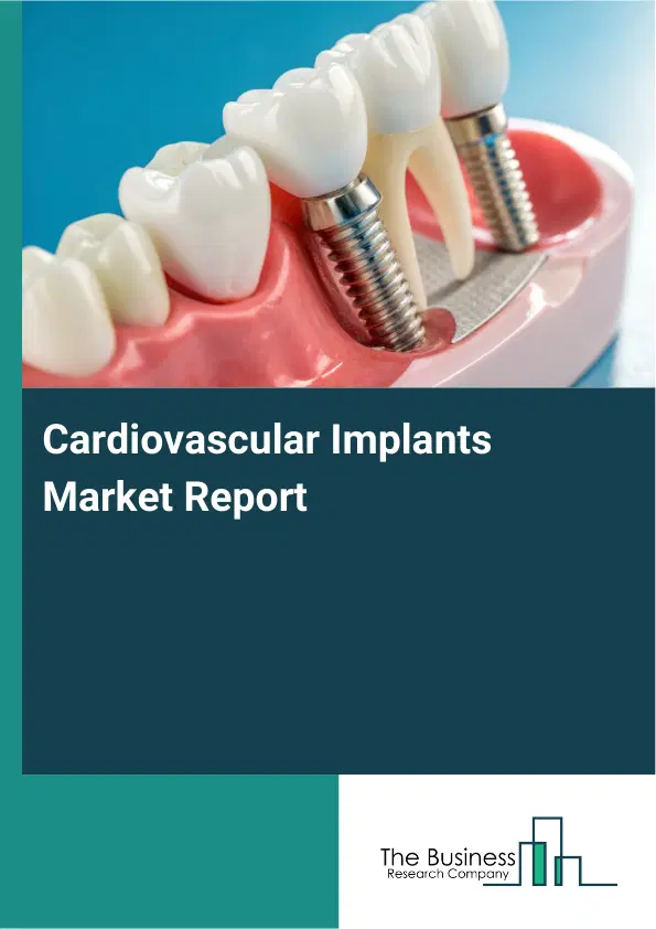 Global Cardiovascular Implants Market Report 2026