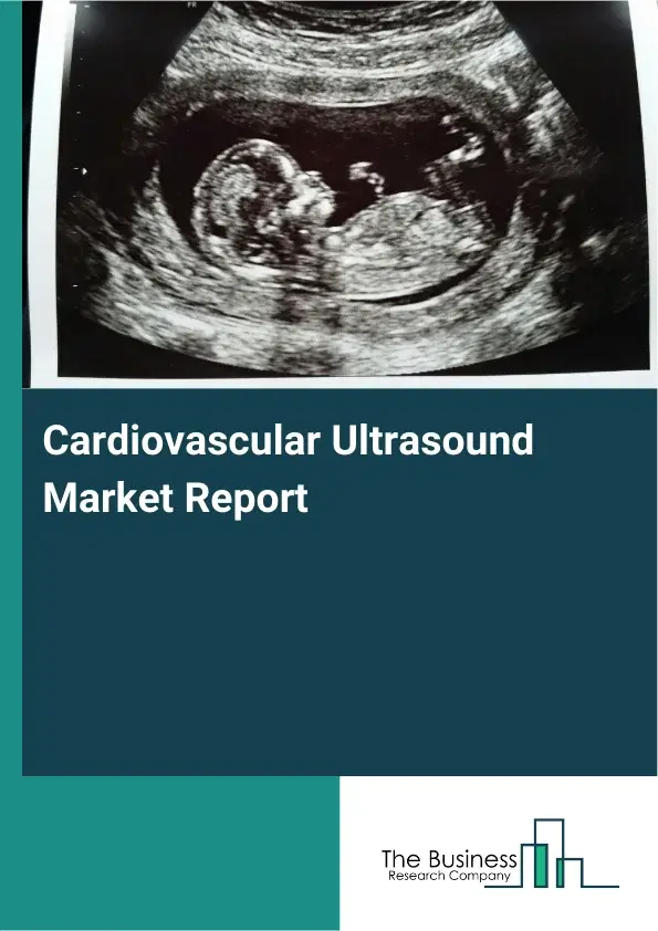 Global Cardiovascular Ultrasound Market Report 2026