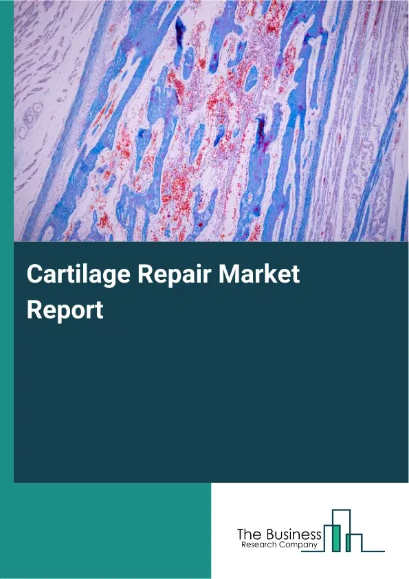 Global Cartilage Repair Market Report 2026
