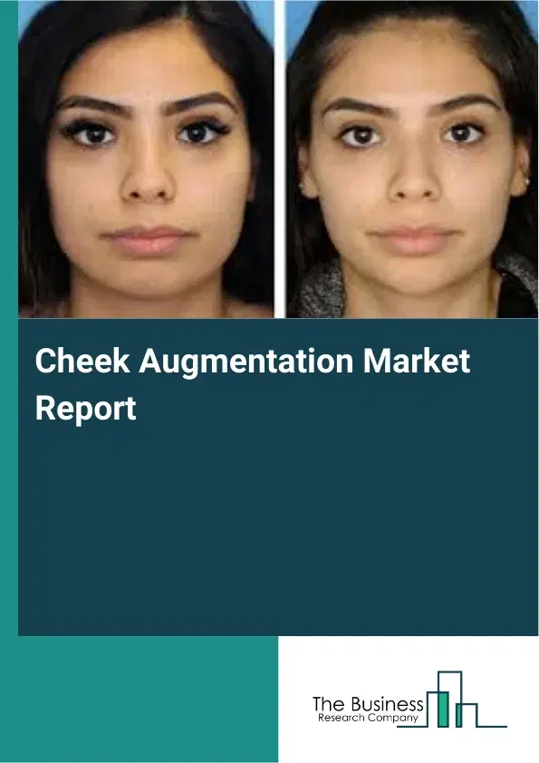 Global Cheek Augmentation Market Report 2026