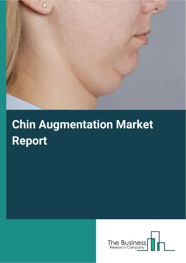 Global Chin Augmentation Market Report 2026