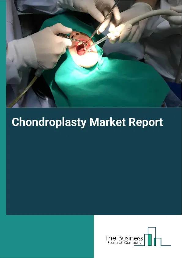 Global Chondroplasty Market Report 2026