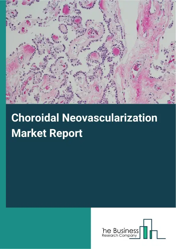 Global Choroidal Neovascularization Market Report 2026