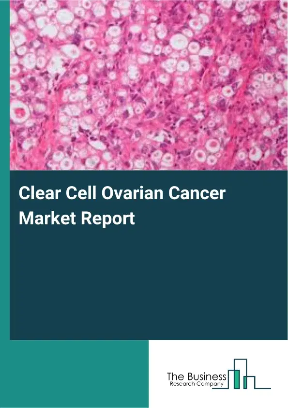 Global Clear Cell Ovarian Cancer Market Report 2026
