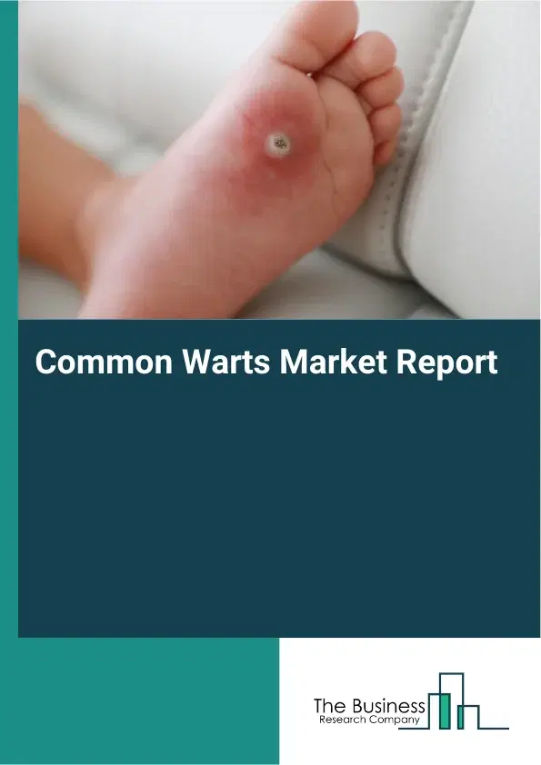 Global Common Warts Market Report 2026