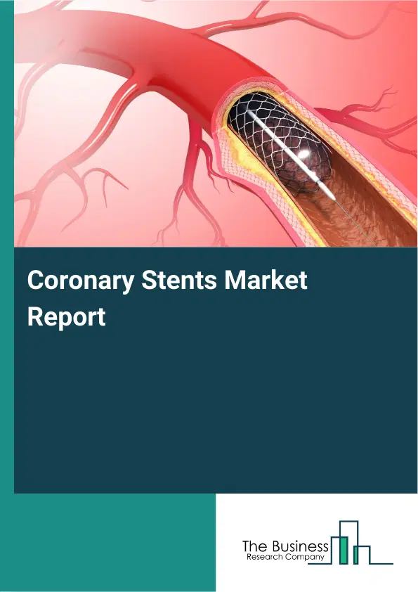 Global Coronary Stents Market Report 2026
