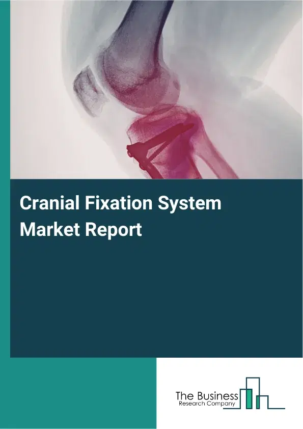 Global Cranial Fixation System Market Report 2026