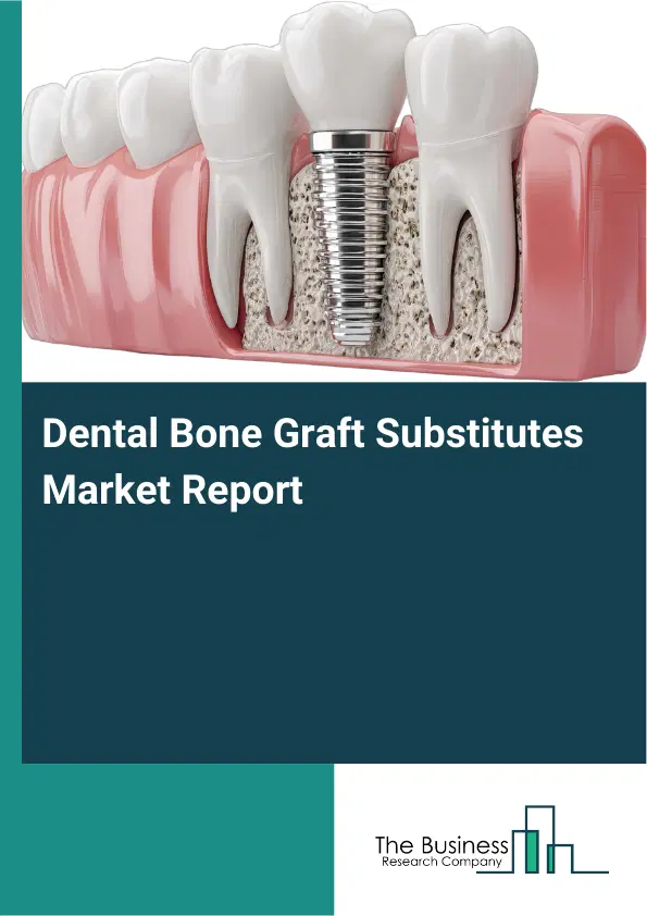 Global Dental Bone Graft Substitutes Market Report 2026