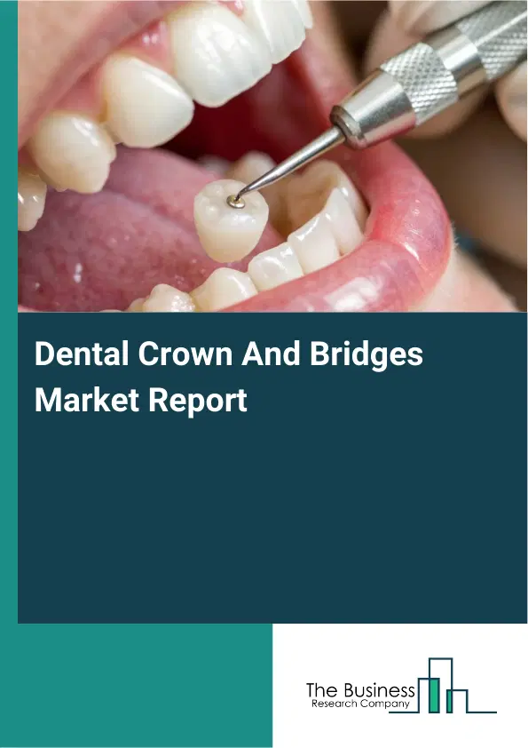 Global Dental Crown And Bridges Market Report 2026