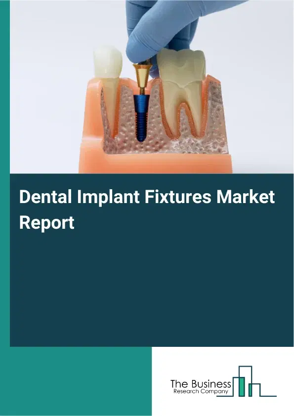 Global Dental Implant Fixtures Market Report 2026