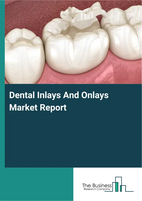 Global Dental Inlays And Onlays Market Report 2026