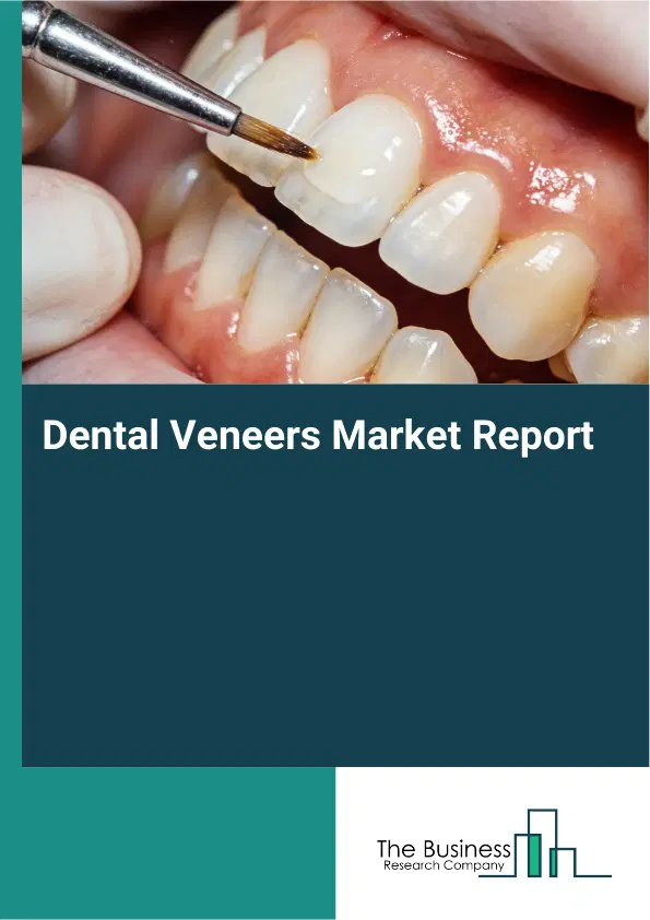 Global Dental Veneers Market Report 2026