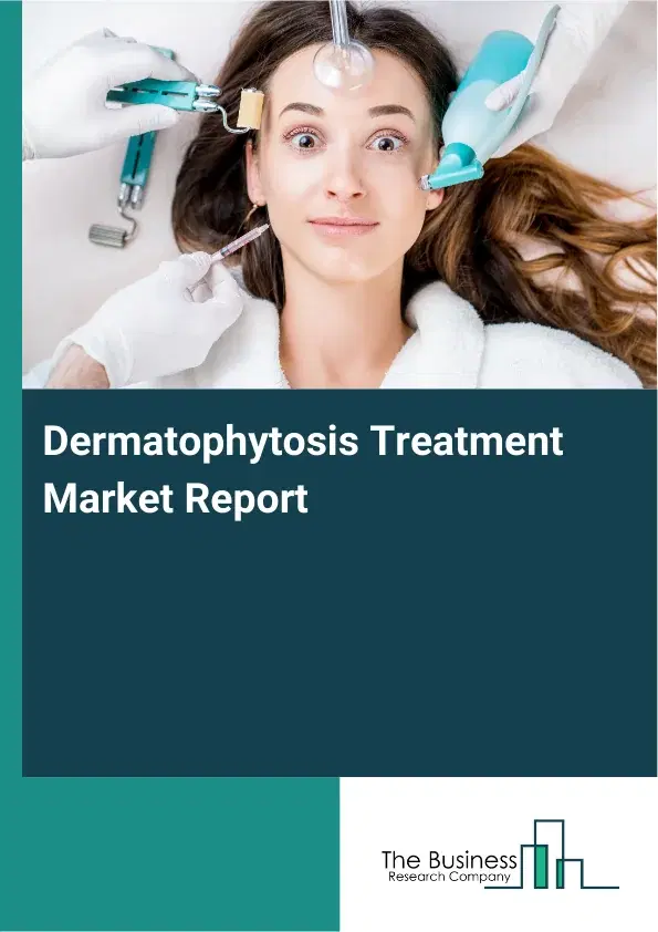 Global Dermatophytosis Treatment Market Report 2026