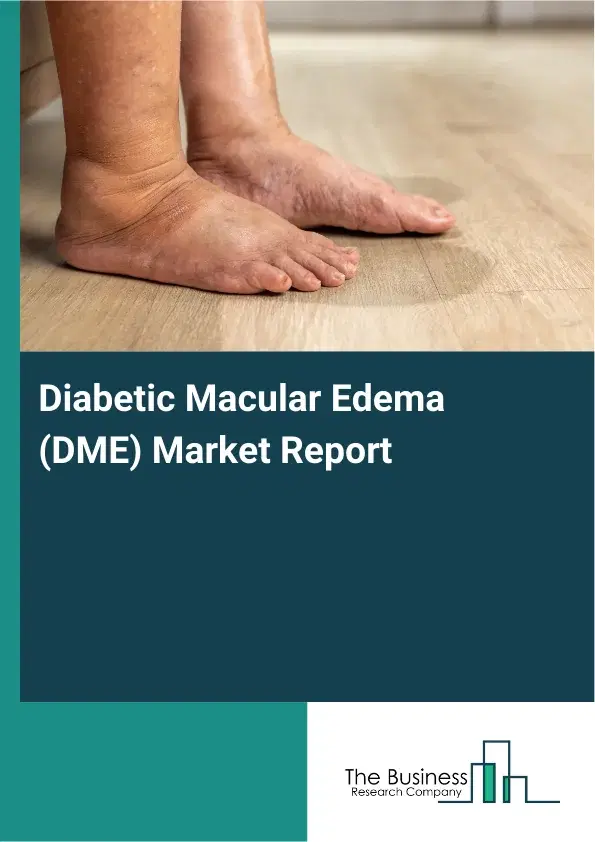 Global Diabetic Macular Edema (DME) Market Report 2026