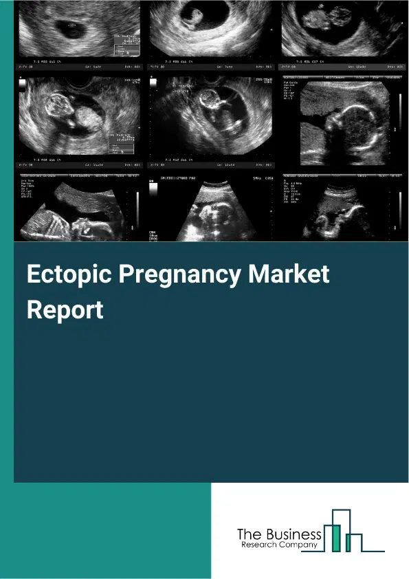 Global Ectopic Pregnancy Market Report 2026
