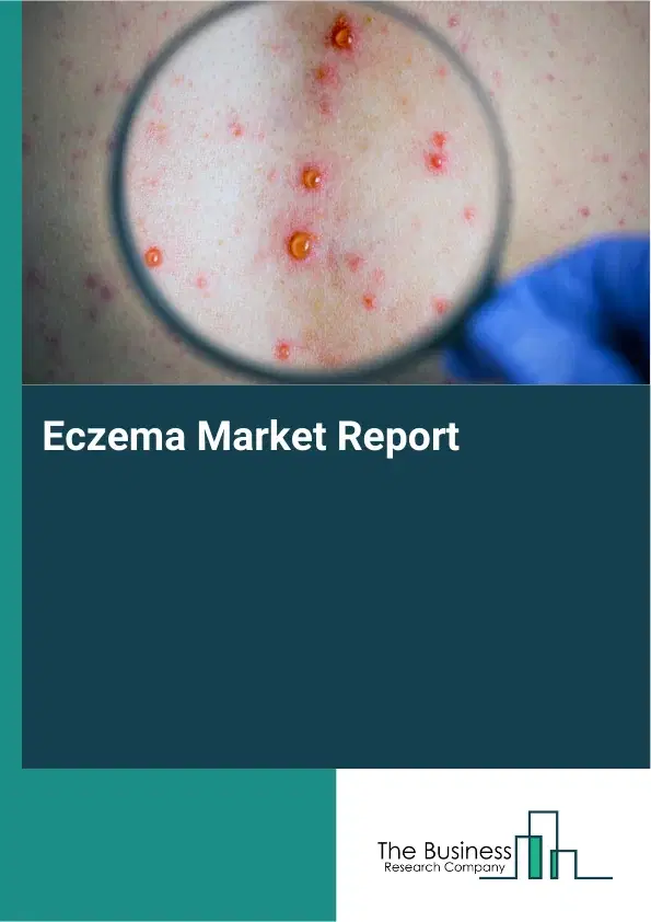 Global Eczema Market Report 2026