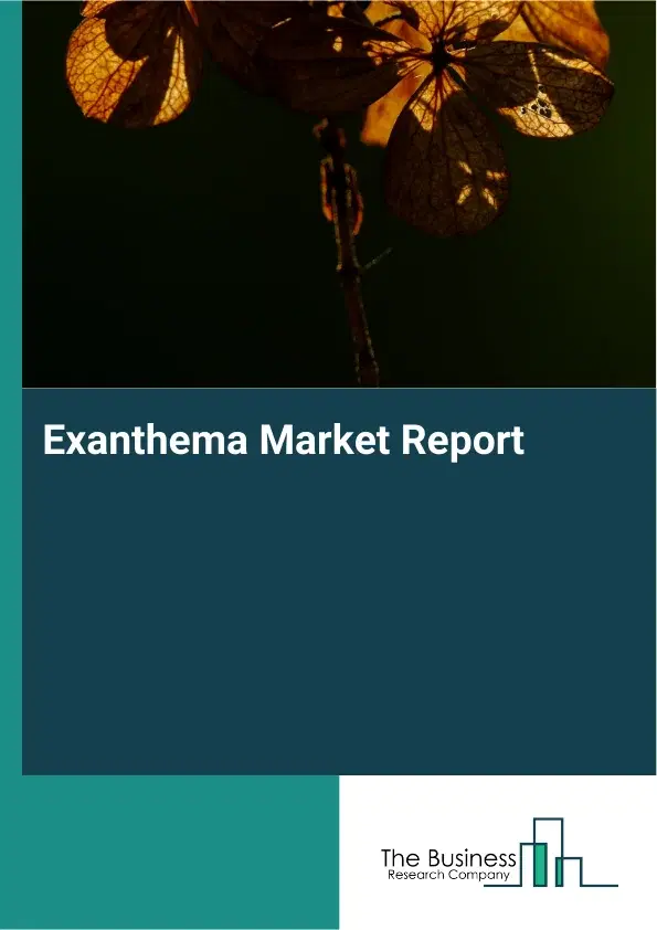 Global Exanthema Market Report 2026