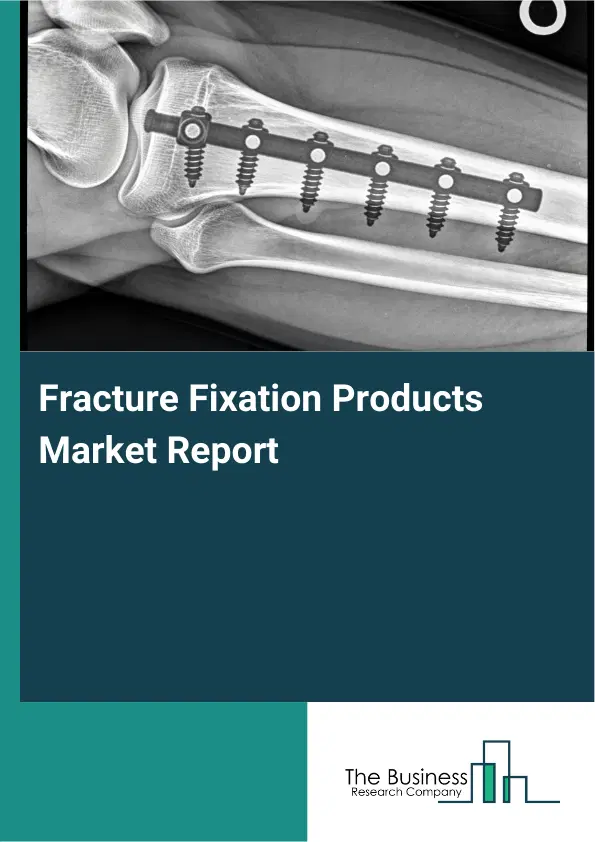 Global Fracture Fixation Products Market Report 2026