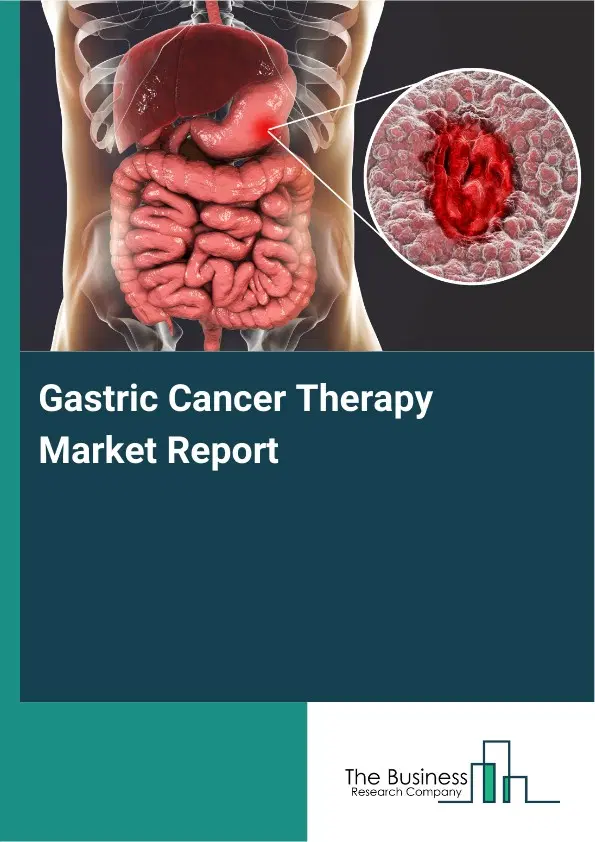 Global Gastric Cancer Therapy Market Report 2026