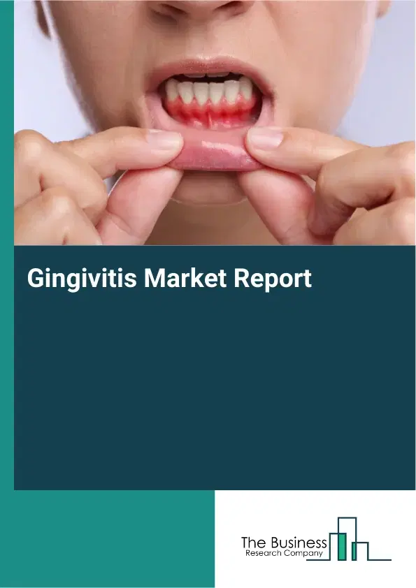 Global Gingivitis Market Report 2026