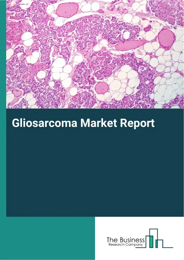 Global Gliosarcoma Market Report 2026