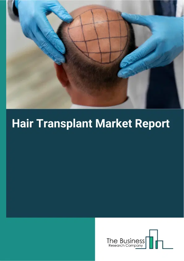 Global Hair Transplant Market Report 2026